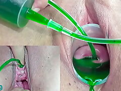 Cervix and Piss Hole Inflation with Insertions for Japanese Lezzies