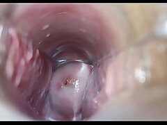 Vaginal orgasm