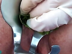 Nettles Ass Handballing Assfucking Insertion Nettles with Speculum