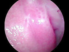Camera deep inwards of the wet pussy and captured the mighty nymph orgasm!!