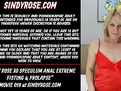 Sindy Rose XO speculum anal invasion extreme fisting & rosebutt