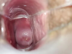 Speculum inwards coochie